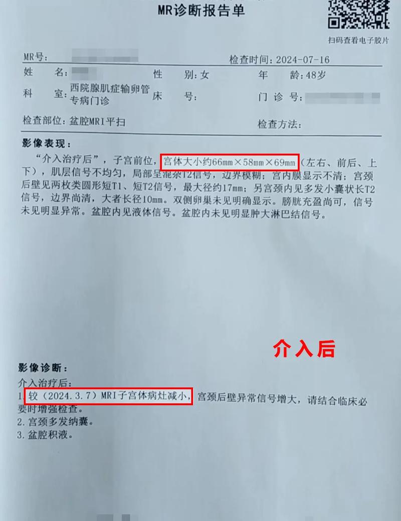 48岁怀孕以为是绝经,48岁怀孕以为是绝经了